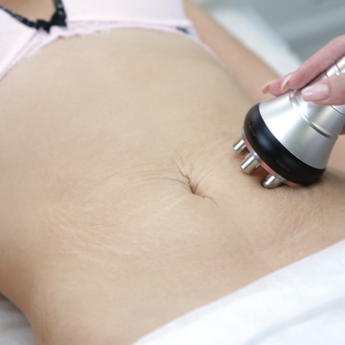 belly treatment